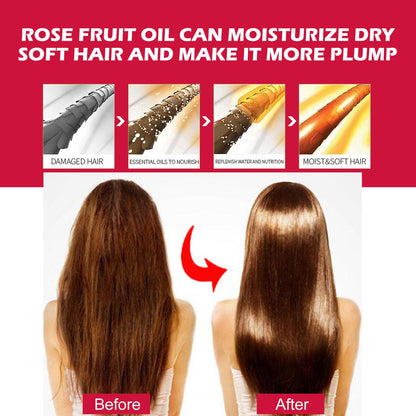 EELHOE Rosehip Facial Oil - Hydrating Multi-Use Oil for Face, Body & Hair